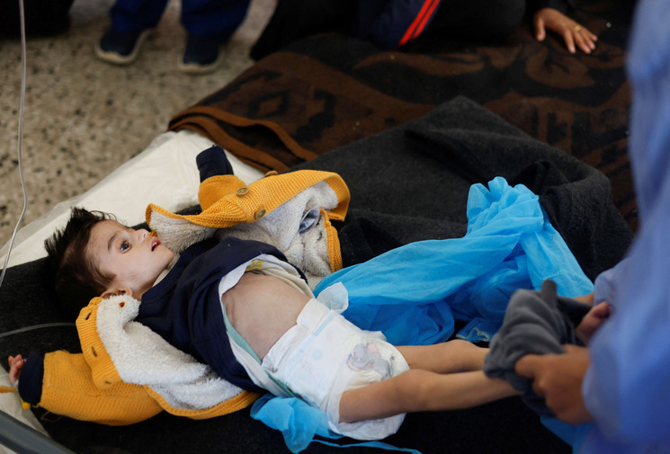 أطفال في انتظار الموت بالمستشفيات مع تفاقم أزمة الجوع في غزة