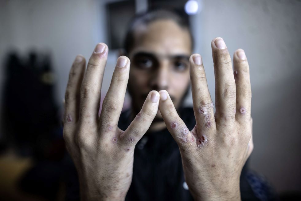 موسيقى صاخبة وتجويع.. تنكيل إسرائيلي بأسرى فلسطينيين من غزة في السجون
