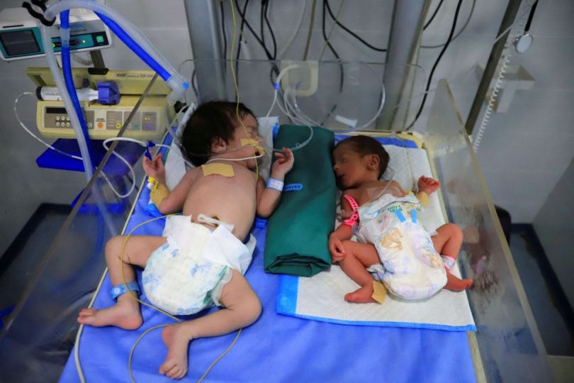 الصحة العالمية: 112 طفلا يدخلون مستشفيات غزة يوميا بسبب سوء التغذية