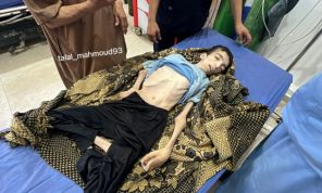 كرم الجمل.. شاب فلسطيني ضحية جديدة لتجويع غزة- (صور) 