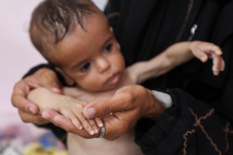 فرنسا: “خطر المجاعة” في غزة هو “نتيجة الحصار” الإسرائيلي