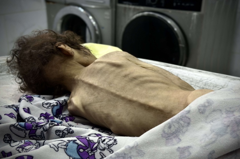 برنامج الأغذية العالمي يرى أن المساعدات الداخلة إلى غزة “قطرة في بحر”