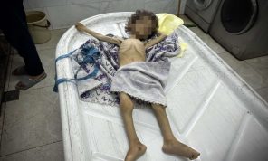 5 وفيات في غزة جراء التجويع الإسرائيلي ترفع الحصيلة لـ387 
